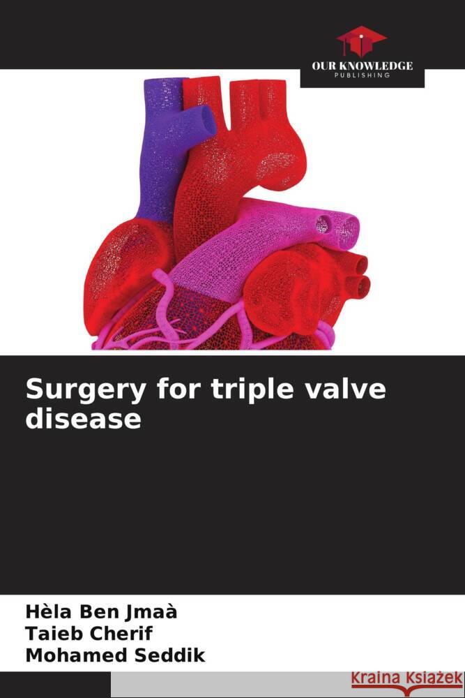 Surgery for triple valve disease H?la Be Taieb Cherif Mohamed Seddik 9786207986446