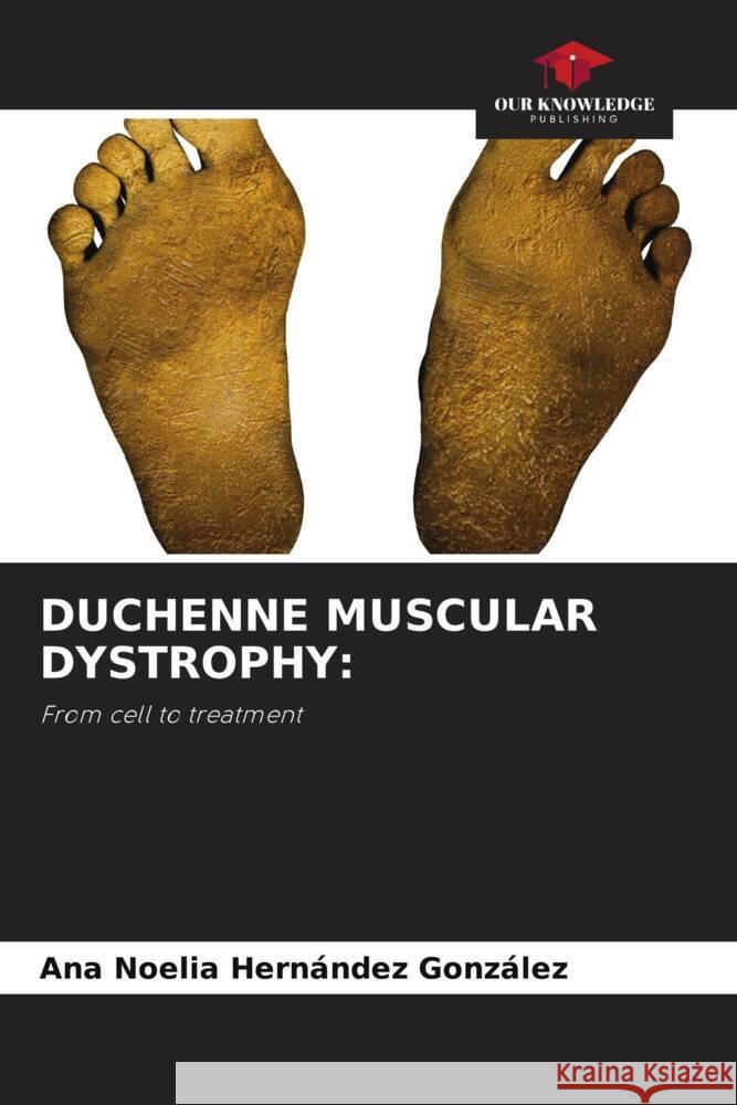 Duchenne Muscular Dystrophy Ana Noelia Hern?nde 9786207988068