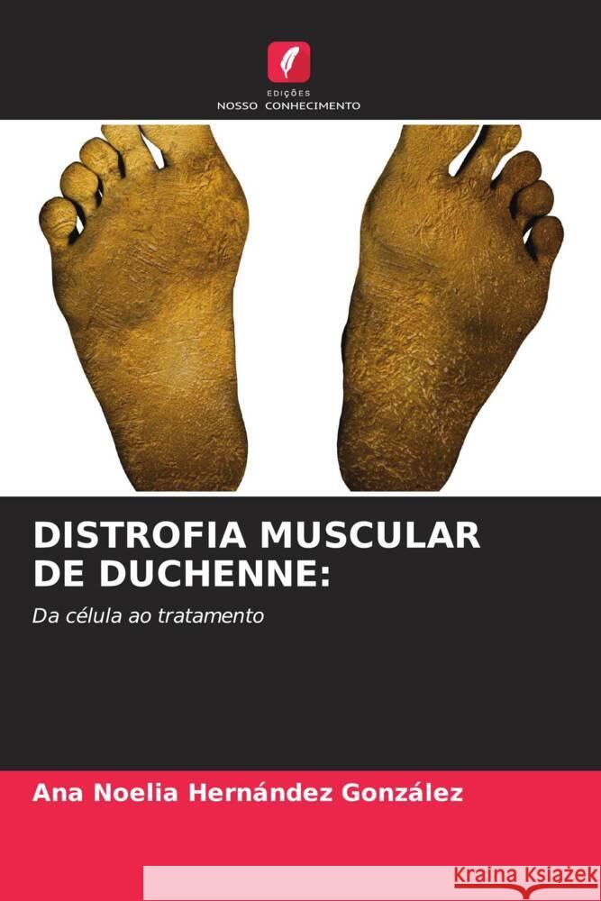 Distrofia Muscular de Duchenne Ana Noelia Hern?nde 9786207988099