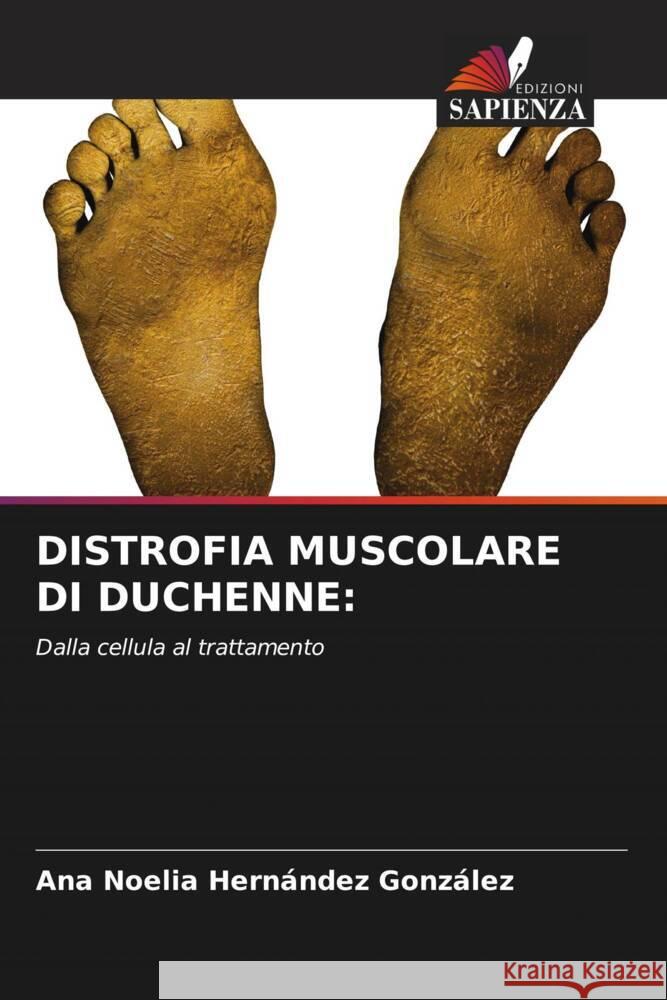 Distrofia Muscolare Di Duchenne Ana Noelia Hern?nde 9786207988112