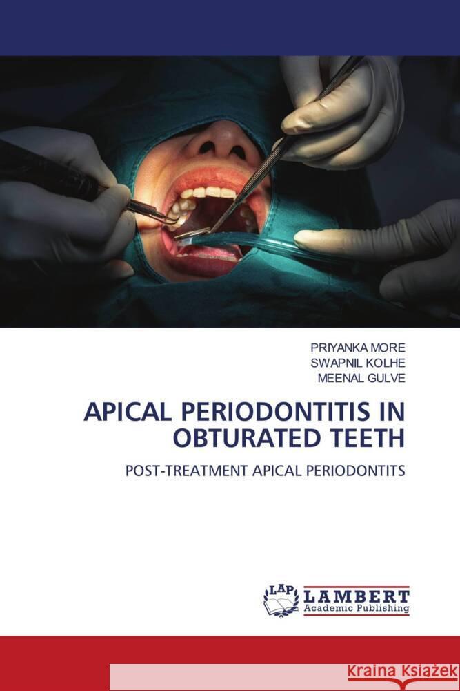 Apical Periodontitis in Obturated Teeth Priyanka More Swapnil Kolhe Meenal Gulve 9786207999057