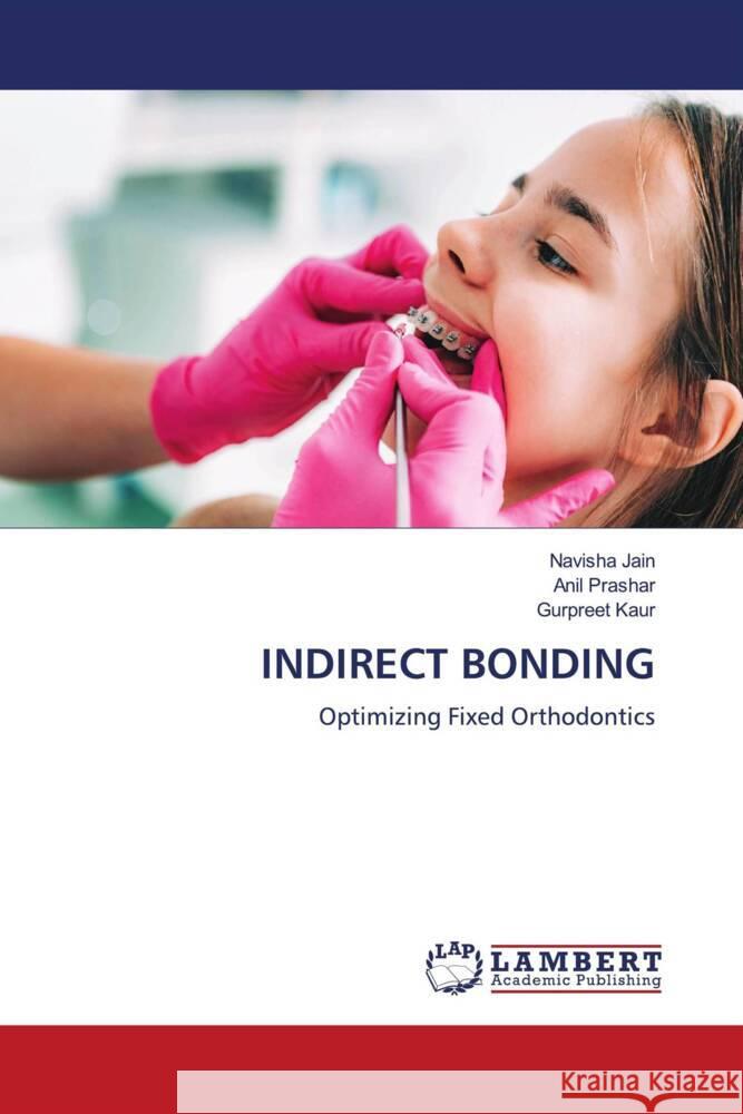 Indirect Bonding Navisha Jain Anil Prashar Gurpreet Kaur 9786208009878