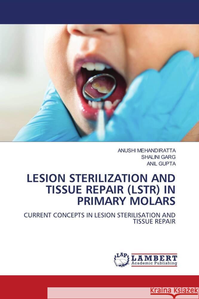 Lesion Sterilization and Tissue Repair (Lstr) in Primary Molars Anushi Mehandiratta Shalini Garg Anil Gupta 9786208010638 LAP Lambert Academic Publishing