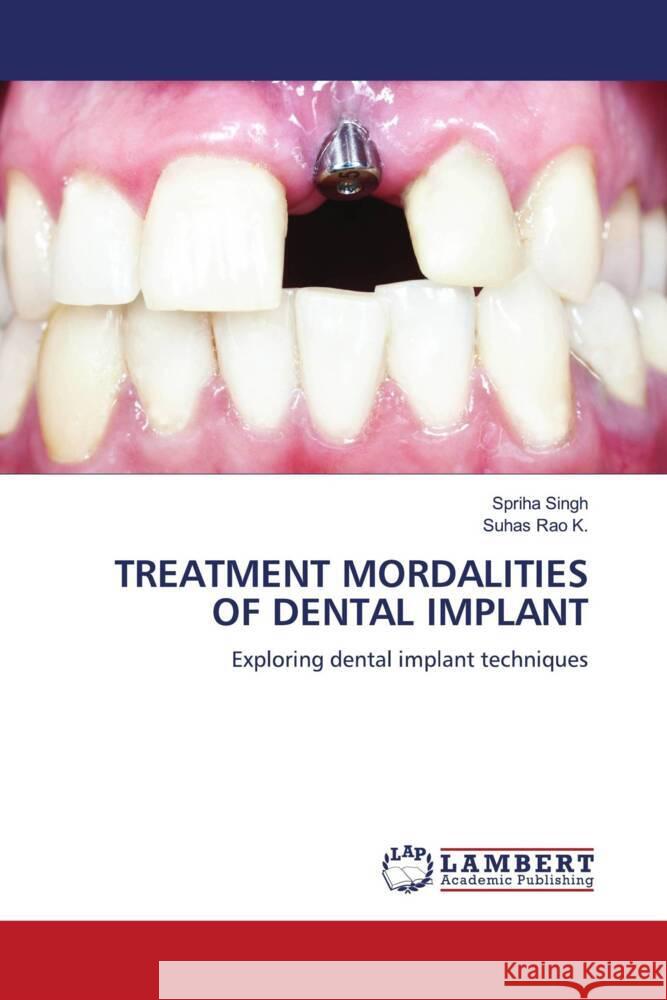 Treatment Mordalities of Dental Implant Spriha Singh Suhas Rao K 9786208010744 LAP Lambert Academic Publishing