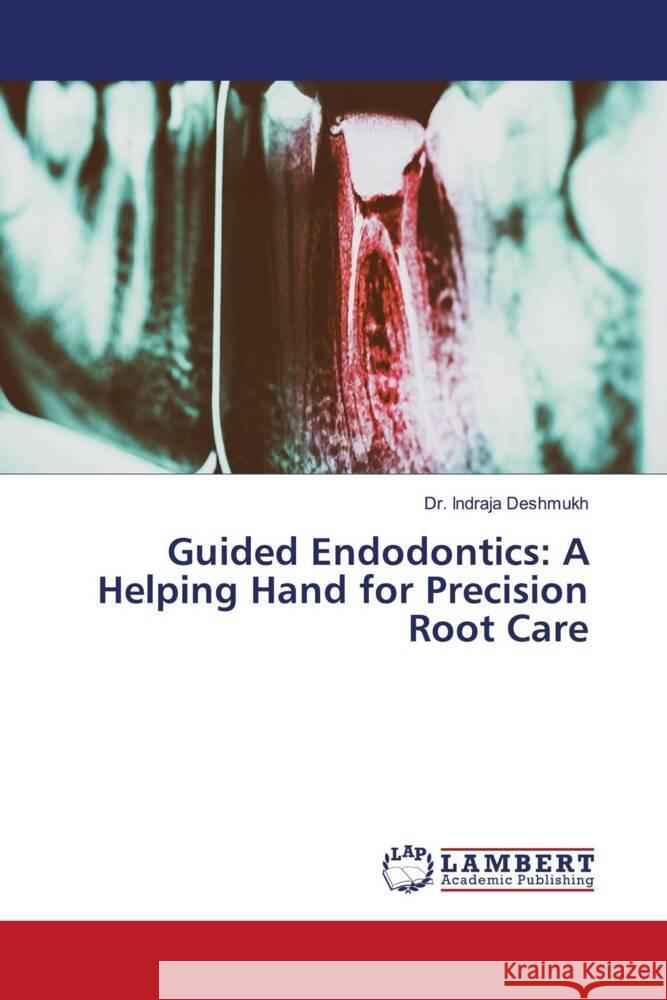 Guided Endodontics: A Helping Hand for Precision Root Care Indraja Deshmukh 9786208012533 LAP Lambert Academic Publishing