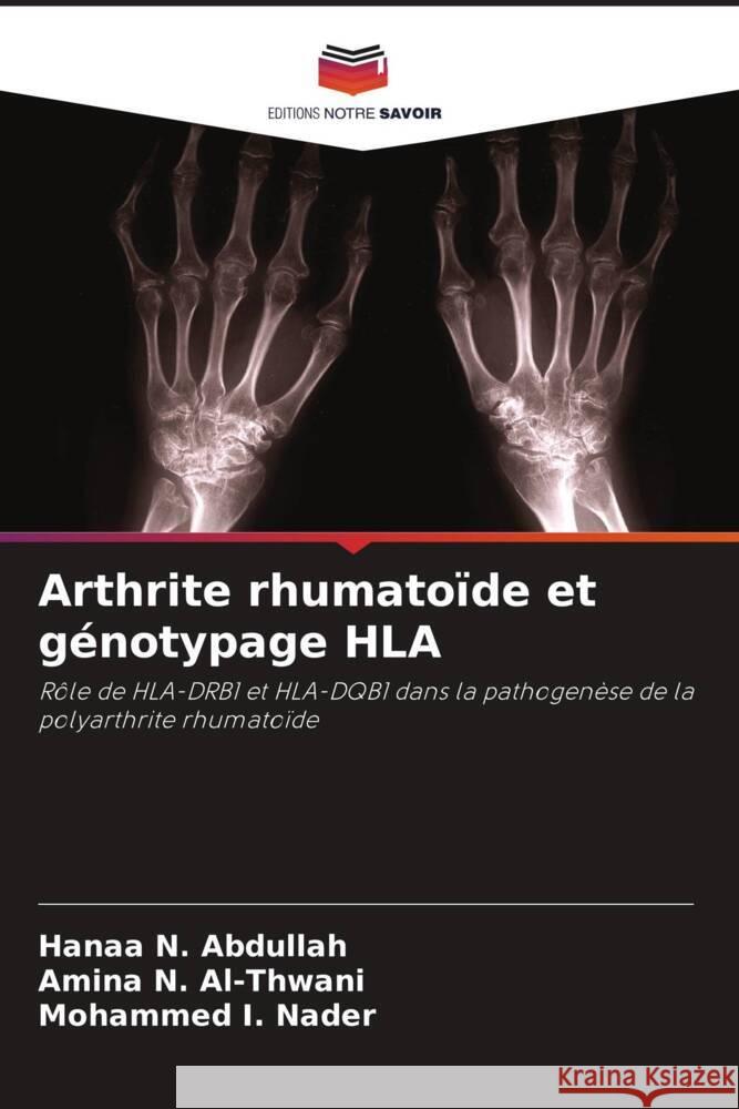 Arthrite rhumato?de et g?notypage HLA Hanaa N. Abdullah Amina N. Al-Thwani Mohammed I. Nader 9786208013943