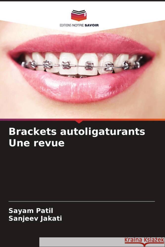 Brackets autoligaturants Une revue Sayam Patil Sanjeev Jakati 9786208020835