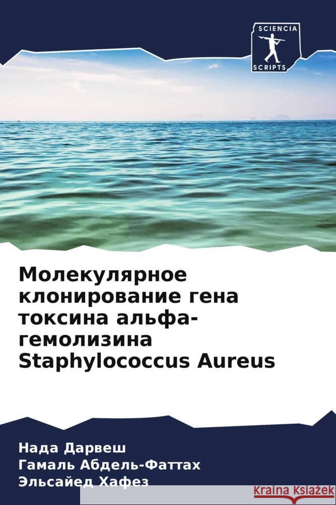 Molekulqrnoe klonirowanie gena toxina al'fa-gemolizina Staphylococcus Aureus Darwesh, Nada, Abdel'-Fattah, Gamal', Hafez, Jel'sajed 9786208035839