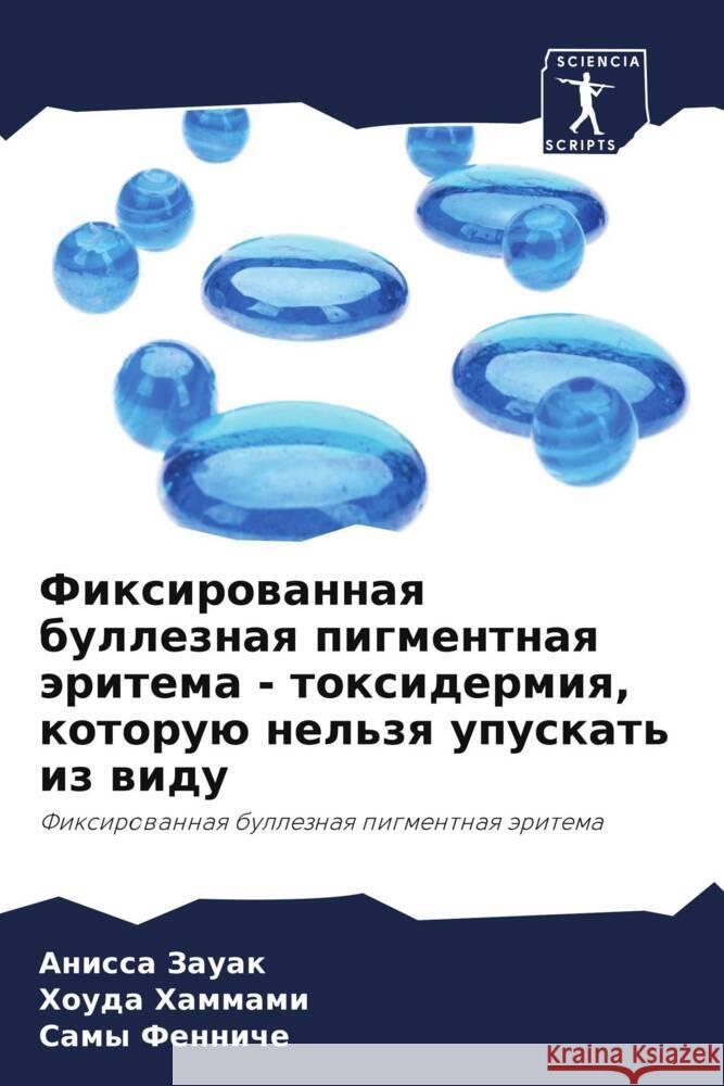 Fixirowannaq bulleznaq pigmentnaq äritema - toxidermiq, kotoruü nel'zq upuskat' iz widu Zauak, Anissa, Hammami, Houda, Fenniche, Samy 9786208041212 Sciencia Scripts