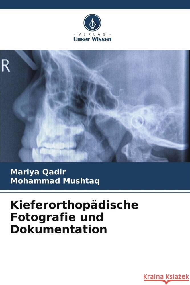 Kieferorthop?dische Fotografie und Dokumentation Mariya Qadir Mohammad Mushtaq 9786208047009 Verlag Unser Wissen