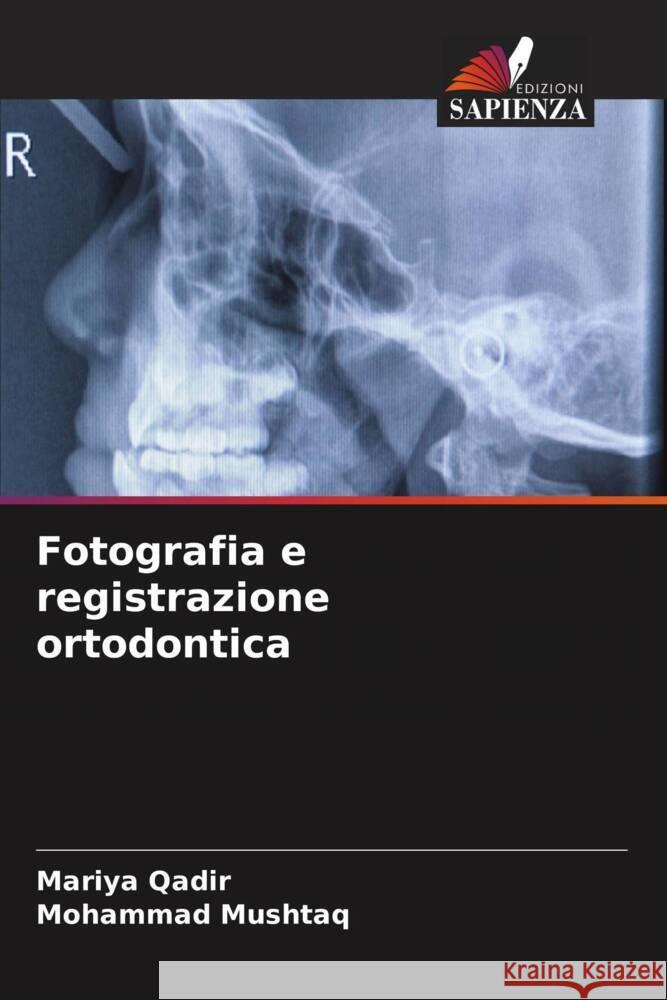 Fotografia e registrazione ortodontica Mariya Qadir Mohammad Mushtaq 9786208047078 Edizioni Sapienza