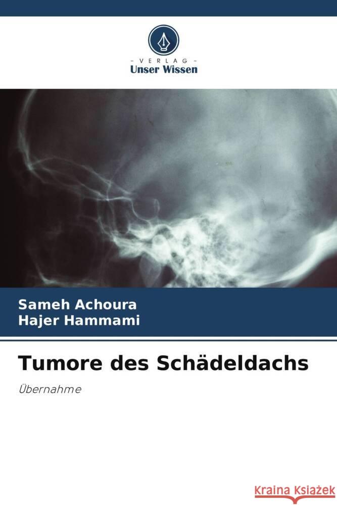 Tumore des Sch?deldachs Sameh Achoura Hajer Hammami 9786208060312 Verlag Unser Wissen