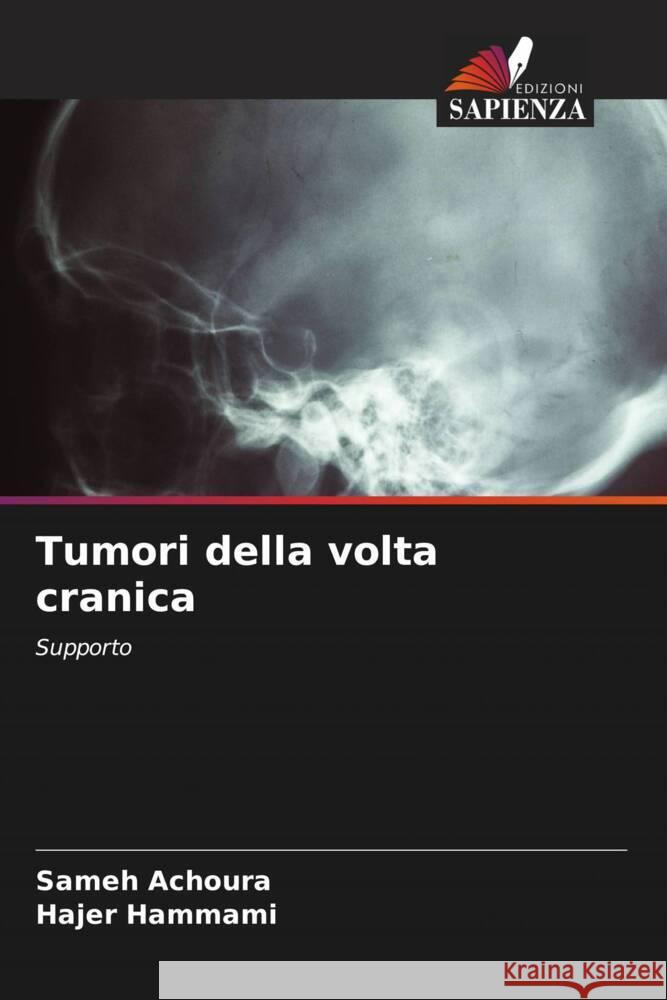 Tumori della volta cranica Sameh Achoura Hajer Hammami 9786208060404 Edizioni Sapienza