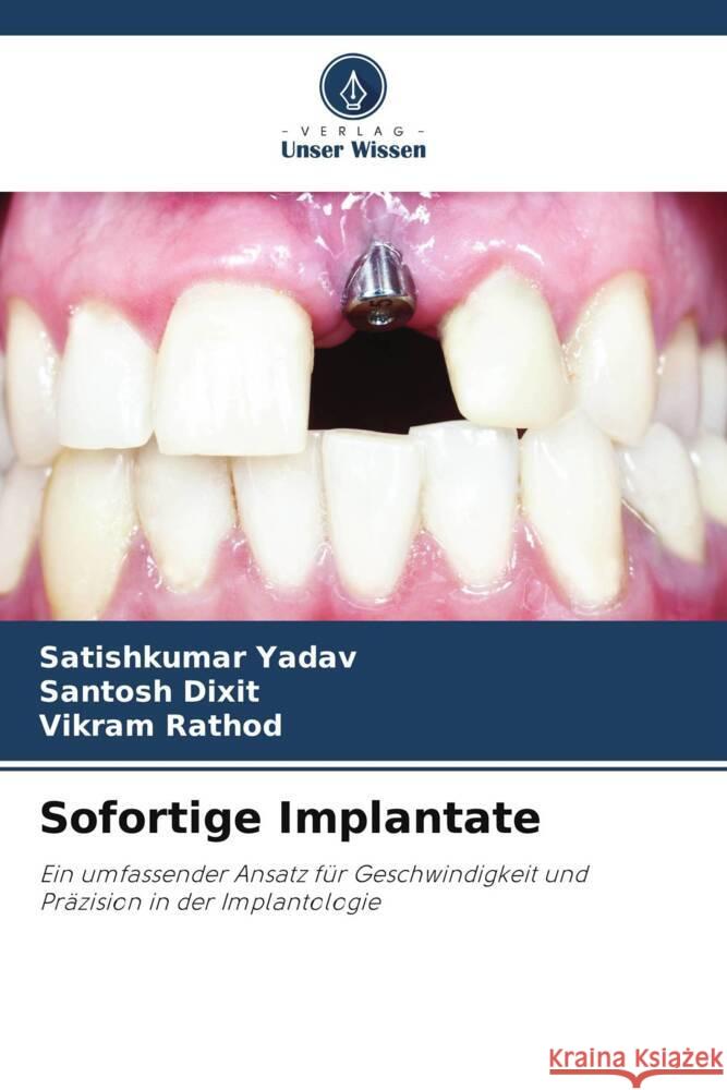 Sofortige Implantate Satishkumar Yadav Santosh Dixit Vikram Rathod 9786208060459