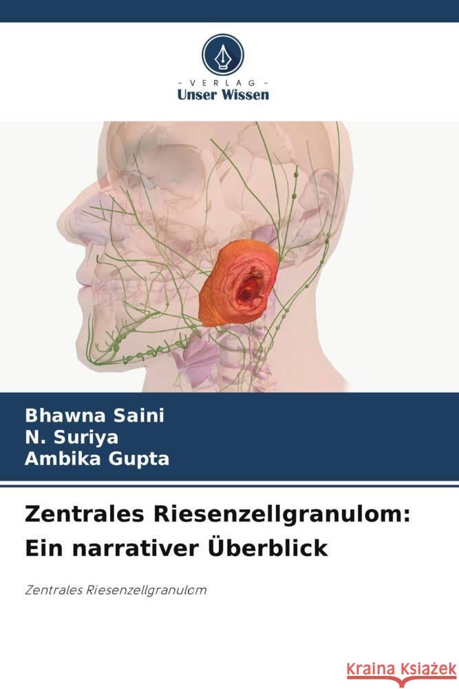 Zentrales Riesenzellgranulom: Ein narrativer ?berblick Bhawna Saini N. Suriya Ambika Gupta 9786208060510 Verlag Unser Wissen