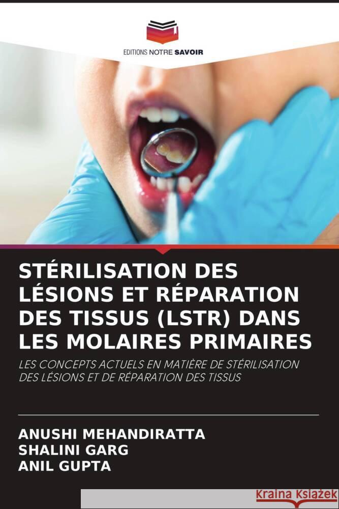 St?rilisation Des L?sions Et R?paration Des Tissus (Lstr) Dans Les Molaires Primaires Anushi Mehandiratta Shalini Garg Anil Gupta 9786208062729 Editions Notre Savoir