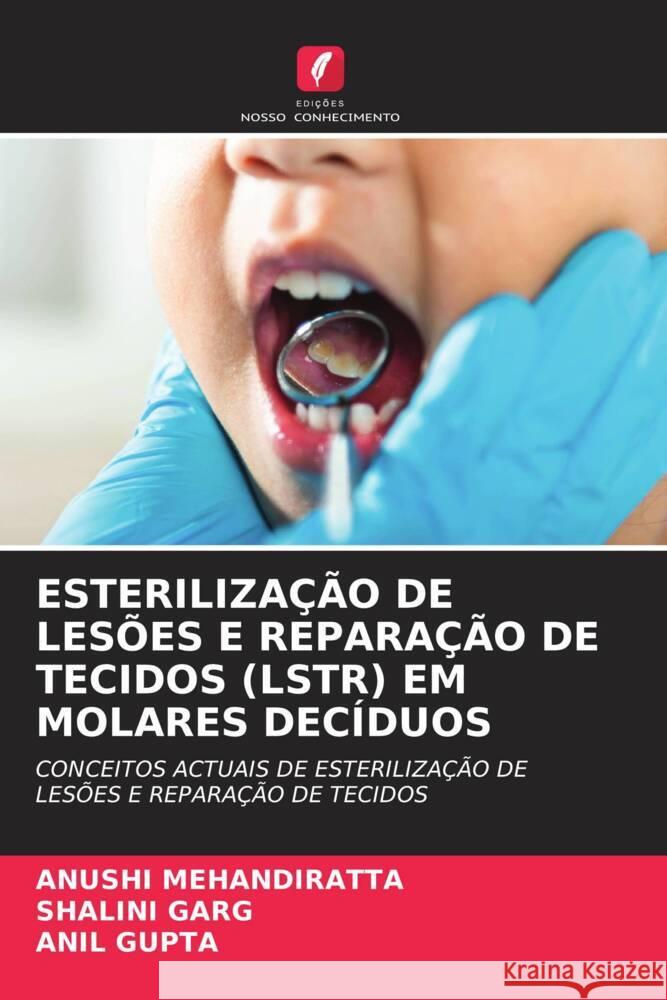 Esteriliza??o de Les?es E Repara??o de Tecidos (Lstr) Em Molares Dec?duos Anushi Mehandiratta Shalini Garg Anil Gupta 9786208062743 Edicoes Nosso Conhecimento