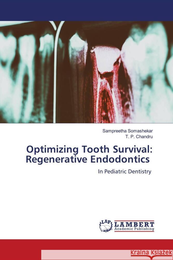 Optimizing Tooth Survival: Regenerative Endodontics Sampreetha Somashekar T. P. Chandru 9786208063498