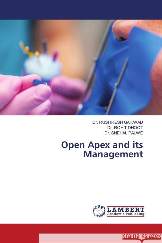 Open Apex and its Management Rushikesh Gaikwad Rohit Dhoot Snehal Palwe 9786208063542 LAP Lambert Academic Publishing