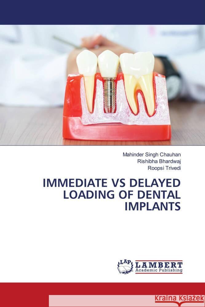 Immediate Vs Delayed Loading of Dental Implants Mahinder Sing Rishibha Bhardwaj Roopsi Trivedi 9786208063931 LAP Lambert Academic Publishing