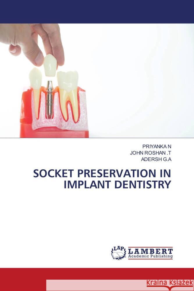 SOCKET PRESERVATION IN IMPLANT DENTISTRY N, PRIYANKA, ROSHAN .T, JOHN, G.A, Adersh 9786208064570