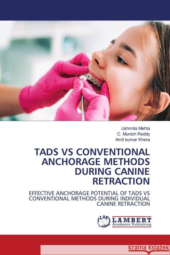 TADS VS CONVENTIONAL ANCHORAGE METHODS DURING CANINE RETRACTION Mehta, Ushmita, Reddy, C. Munish, Khera, Amit Kumar 9786208065560