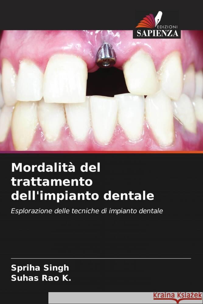Mordalit? del trattamento dell'impianto dentale Spriha Singh Suhas Rao K 9786208069377 Edizioni Sapienza
