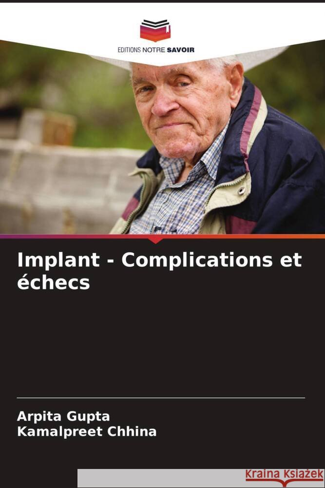 Implant - Complications et ?checs Arpita Gupta Kamalpreet Chhina 9786208073251 Editions Notre Savoir
