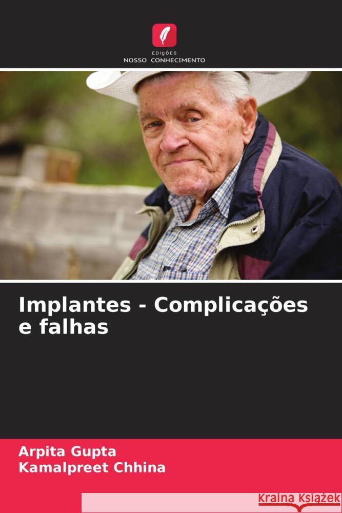 Implantes - Complica??es e falhas Arpita Gupta Kamalpreet Chhina 9786208073275 Edicoes Nosso Conhecimento
