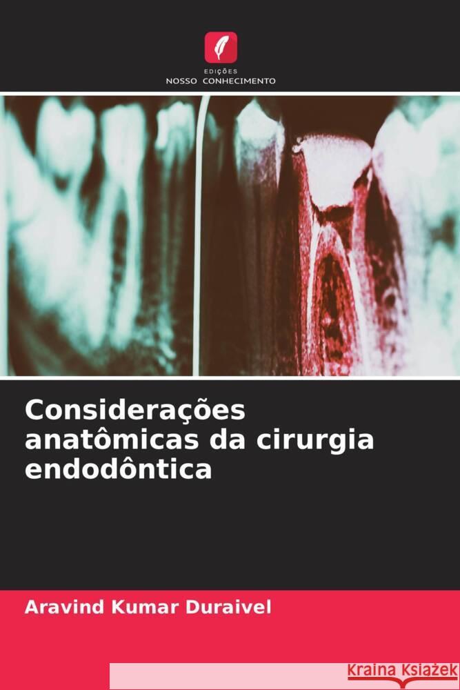 Considerações anatômicas da cirurgia endodôntica Duraivel, Aravind Kumar 9786208081188