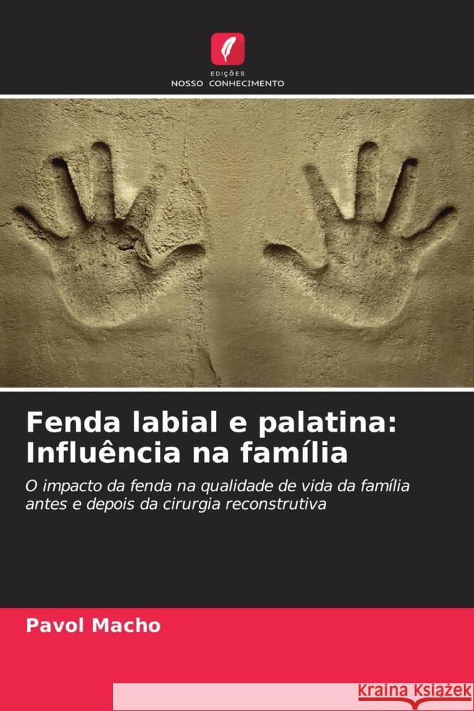 Fenda labial e palatina: Influência na família Macho, Pavol 9786208089924