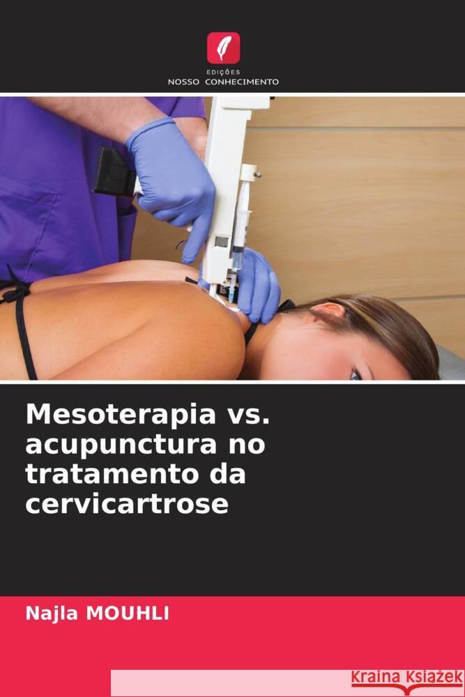 Mesoterapia vs. acupunctura no tratamento da cervicartrose Najla Mouhli 9786208093464