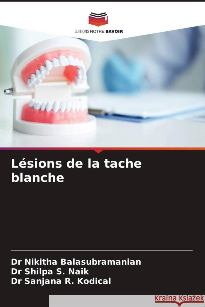 Lésions de la tache blanche Balasubramanian, Dr Nikitha, S. Naik, Dr Shilpa, R. Kodical, Dr Sanjana 9786208096168