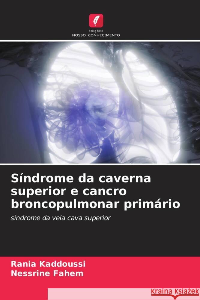 S?ndrome da caverna superior e cancro broncopulmonar prim?rio Rania Kaddoussi Nessrine Fahem 9786208102142