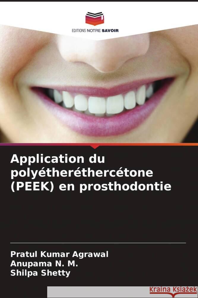 Application du poly?ther?therc?tone (PEEK) en prosthodontie Pratul Kumar Agrawal Anupama N Shilpa Shetty 9786208103811 Editions Notre Savoir