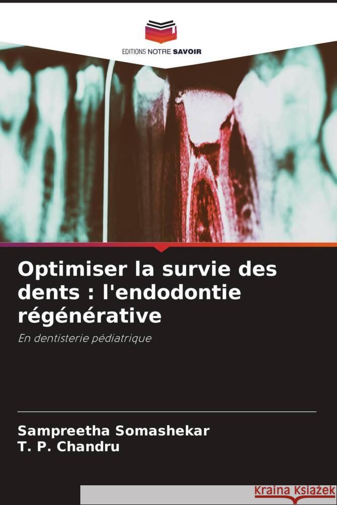 Optimiser la survie des dents: l'endodontie r?g?n?rative Sampreetha Somashekar T. P. Chandru 9786208107802