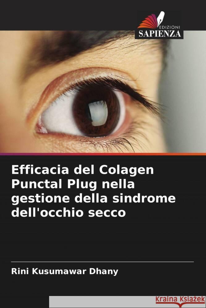 Efficacia del Colagen Punctal Plug nella gestione della sindrome dell'occhio secco Rini Kusumawa 9786208108786 Edizioni Sapienza