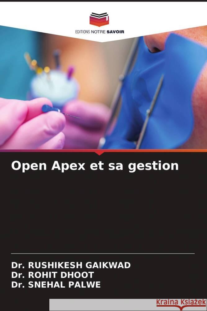 Open Apex et sa gestion Rushikesh Gaikwad Rohit Dhoot Snehal Palwe 9786208110109 Editions Notre Savoir