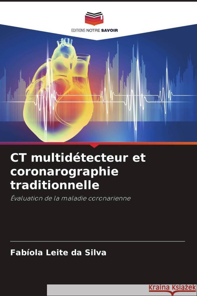 CT multid?tecteur et coronarographie traditionnelle Fab?ola Leit 9786208112370 Editions Notre Savoir