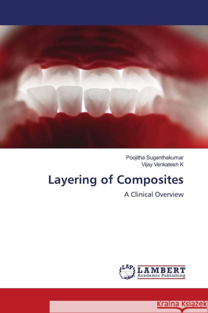 Layering of Composites Suganthakumar, Poojitha, Venkatesh K, Vijay 9786208116064