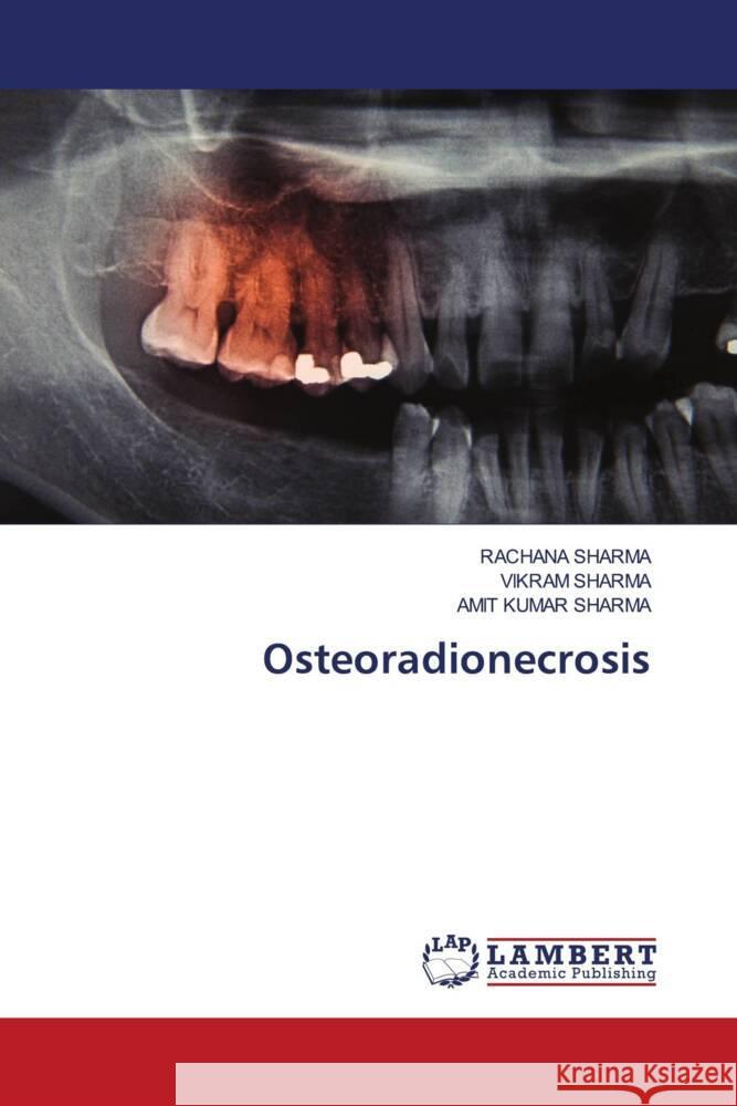 Osteoradionecrosis Rachana Sharma Vikram Sharma Amit Kumar Sharma 9786208117085