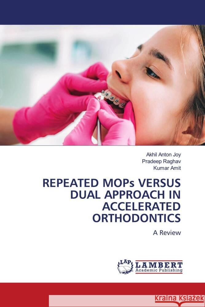 REPEATED MOPs VERSUS DUAL APPROACH IN ACCELERATED ORTHODONTICS Joy, Akhil Anton, Raghav, Pradeep, Amit, Kumar 9786208117146