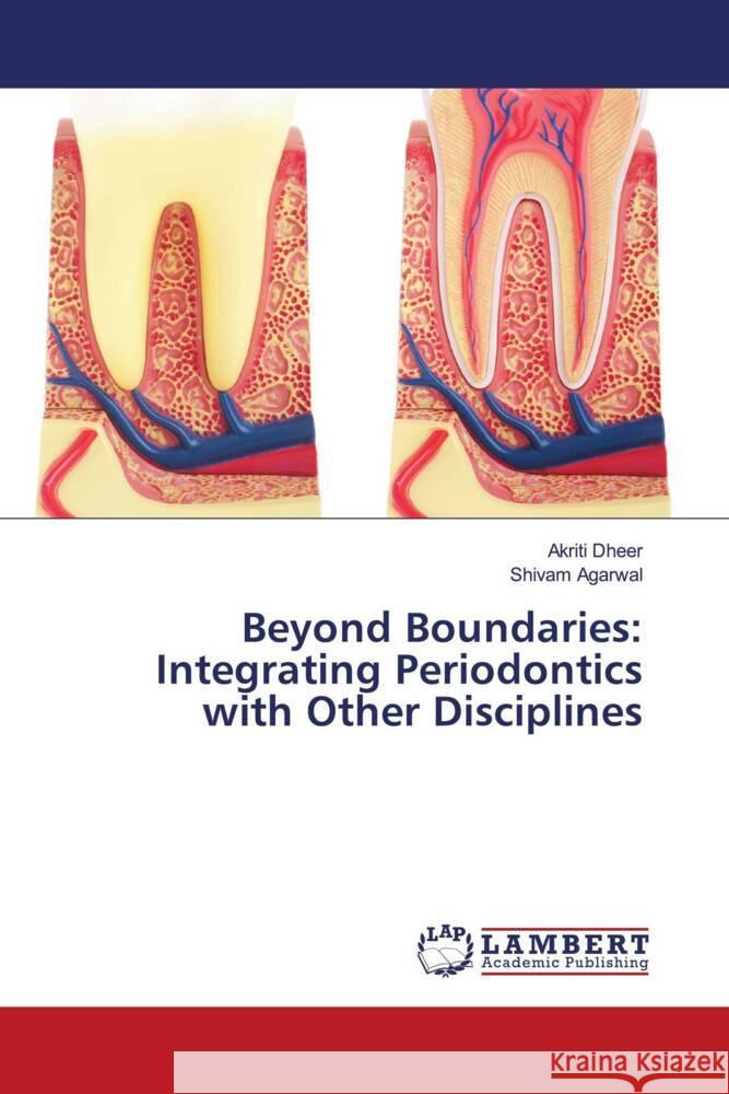 Beyond Boundaries: Integrating Periodontics with Other Disciplines Dheer, Akriti, Agarwal, Shivam 9786208117733