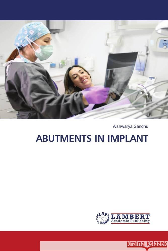 ABUTMENTS IN IMPLANT Sandhu, Aishwarya 9786208119270