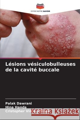 Lésions vésiculobulleuses de la cavité buccale Dawrani, Palak, Handa, Hina, Shinde, Cristopher Vinay 9786208119324