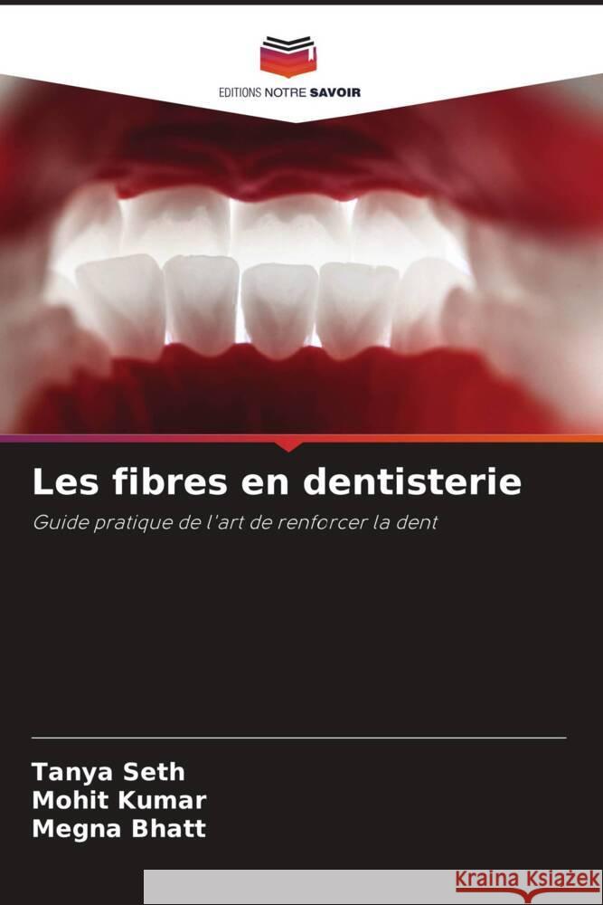 Les fibres en dentisterie Tanya Seth Mohit Kumar Megna Bhatt 9786208126896