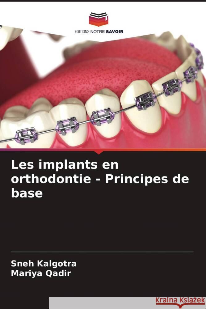 Les implants en orthodontie - Principes de base Sneh Kalgotra Mariya Qadir 9786208131128 Editions Notre Savoir