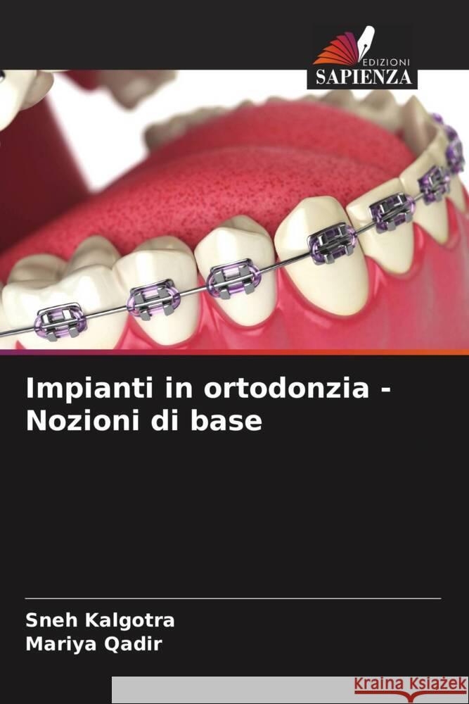 Impianti in ortodonzia - Nozioni di base Sneh Kalgotra Mariya Qadir 9786208131135 Edizioni Sapienza