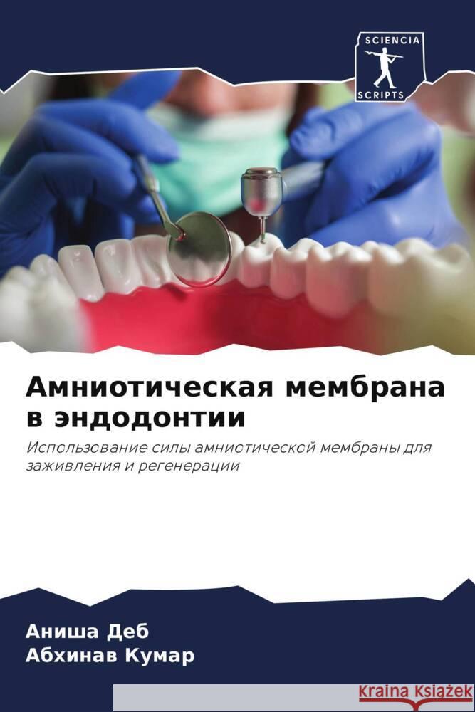 Amnioticheskaq membrana w ändodontii Deb, Anisha, Kumar, Abhinaw 9786208139827