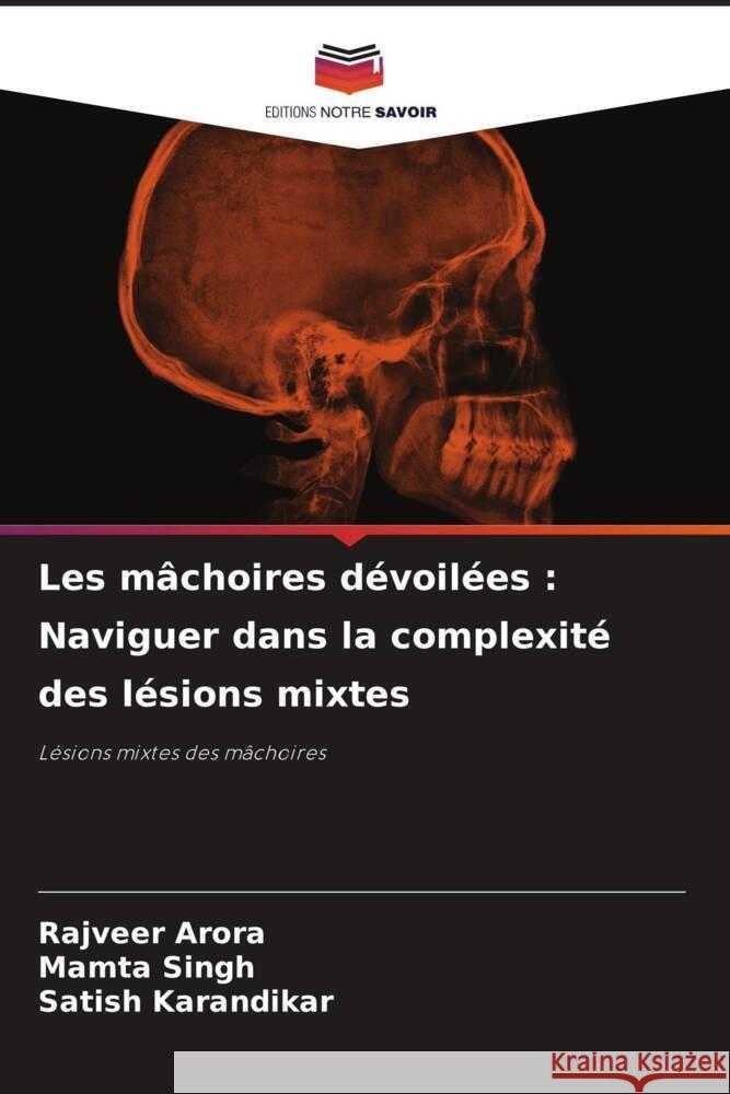 Les m?choires d?voil?es: Naviguer dans la complexit? des l?sions mixtes Rajveer Arora Mamta Singh Satish Karandikar 9786208152178